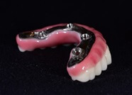 Μέθοδος All-on-4 - μπάρα τιτανίου και δόντια από ζιρκόνιο 